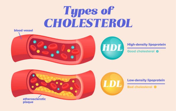 This advanced cholesterol testing