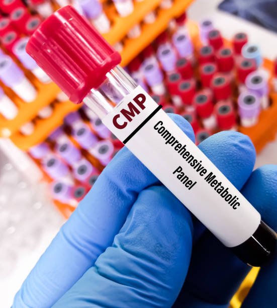 Comprehensive Metabolic Panel (CMP)