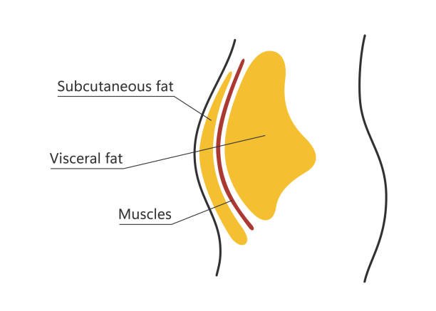 Belly Fat and obesity