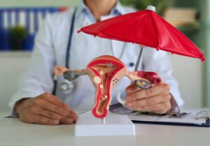 Insulin Resistance and PCOS