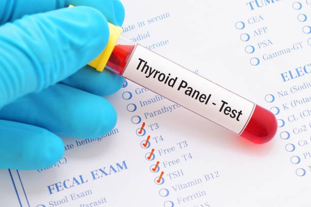Thyroid Hormone Test and Hormone Imbalance