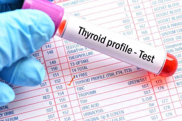 Thyroid Disorder Symptoms Test