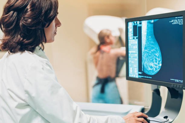 Diagnostic Mammogram